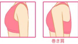 巻き肩って？